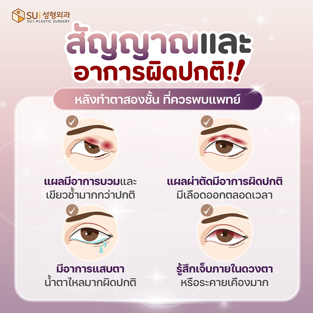 ความผิดปกติหลังทำตาสองชั้น