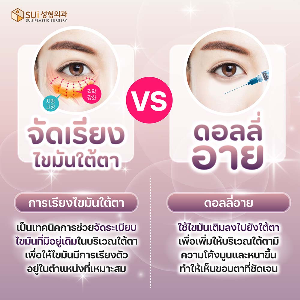 จัดเรียงไขมันใต้ตา vs ดอลลี่อาย