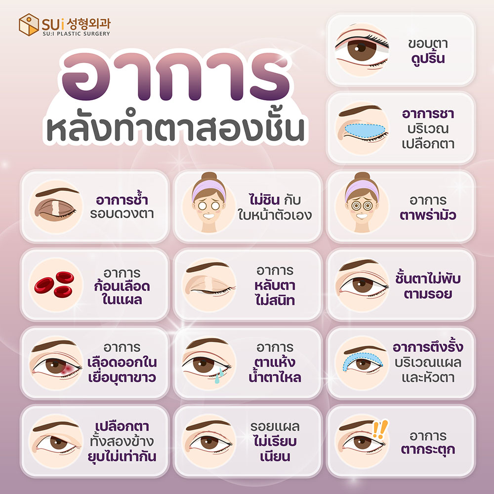 อาการหลังทำตาสองชั้น