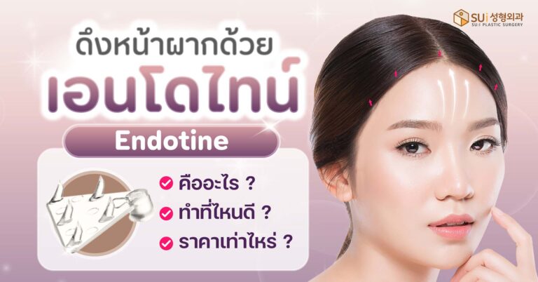 เอนโดไทน์ endotine